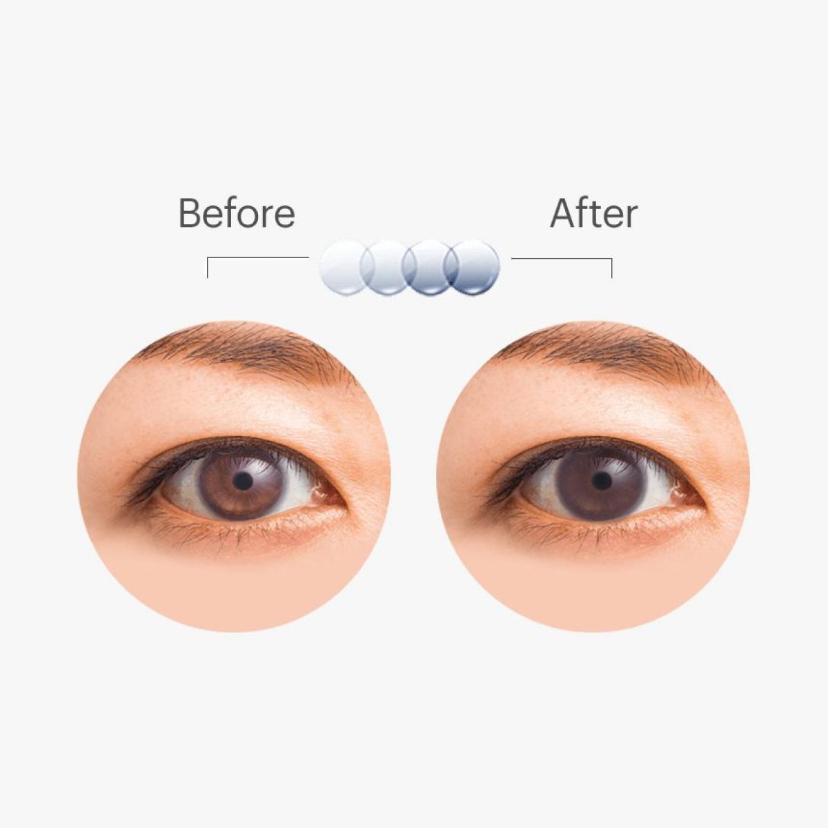 ACUVUE OASYS WITH TRANSITIONS ΦΩΤΟΧΡΩΜΙΚΟΙ ΔΕΚΑΠΕΝΘΗΜΕΡΟΙ ΦΑΚΟΙ ΕΠΑΦΗΣ ΜΥΩΠΙΑΣ ΥΠΕΡΜΕΤΡΩΠΙΑΣ (6 ΦΑΚΟΙ)